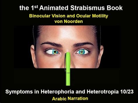 馬竇氏鏡|Motor Signs in Heterophoria and Heterotropia